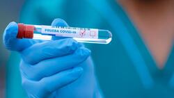 Тест на коронавирус показал положительный результат у 20 борисовцев за минувшую неделю