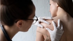 Белгородский дерматовенеролог Ольга Нухова напомнила о важности профилактики кожных заболеваний