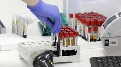 В Белгородской области зарегистрировано 5827  случаев заболеваний ОРВИ 