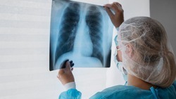 Фтизиатр Тамара Малыхина рассказала белгородцам о необходимости регулярной диагностики туберкулёза